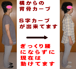 ぎっくり腰にならずに働け、お腹と足が細くなられた事例