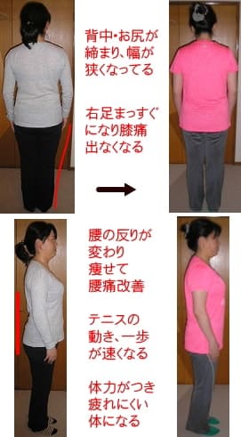 腰痛・膝痛が改善、テニスも向上事例写真