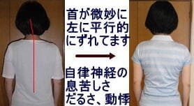 自律神経失調症、だるさ、動悸が治まった姿勢写真