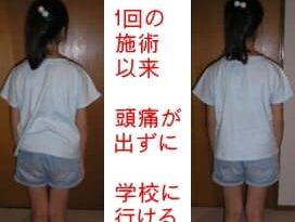 頭痛がなくなり、学校に行けるようになった姿勢写真