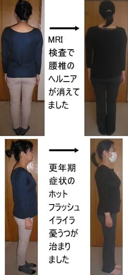 ヘルニアが消えて、もう痛くないです、という姿勢の写真